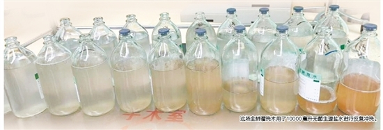 這場全肺灌洗術(shù)用了10000毫升無菌生理鹽水進行反復(fù)沖洗。
